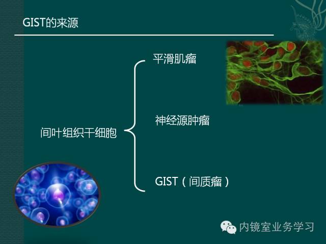 什么是间质瘤