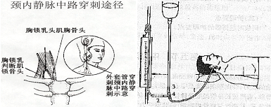 中心静脉压的正常值